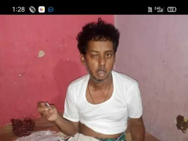 My Friend Sajeed Khan Is Fighting With Black Fungus, Please Help Him.