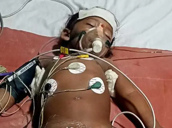 Help My (18-Month-Old) Cousin Brother To Save His Life