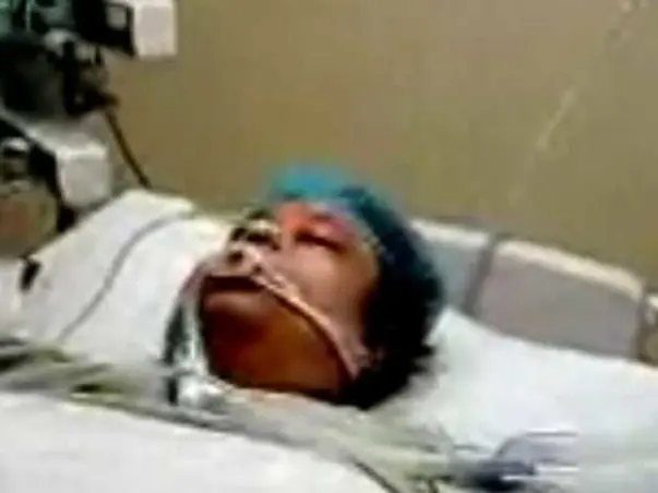 Help My Wife Recover From Covid 19 and Lung Infection