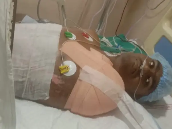 Burns injured Manoj needs your help