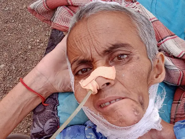 Help My Mother Recover From Oral cancer