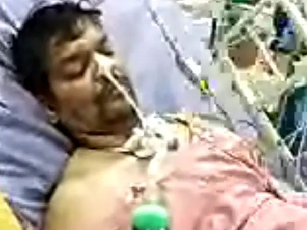 Support My Cousin To Recover From  Covid  And Lung Infection
