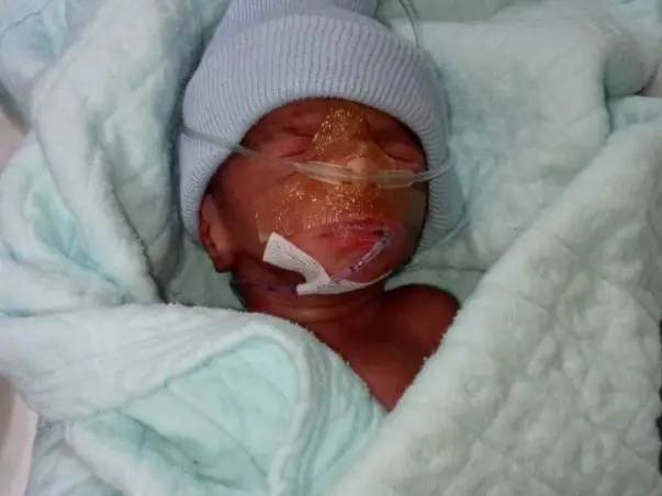Financial Support Needed For My Nephew's Treatment