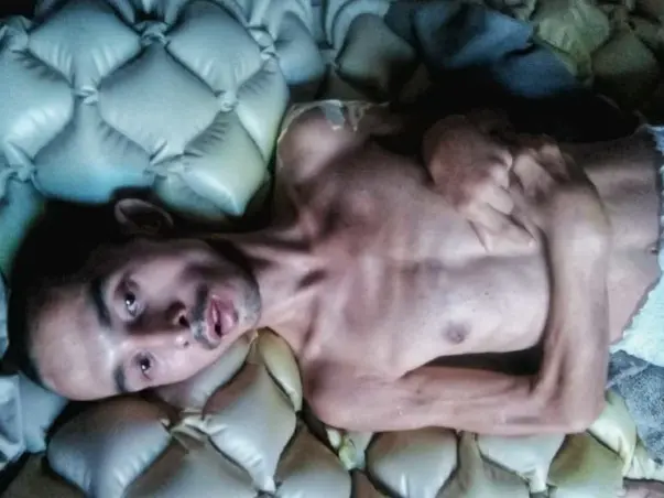 Help Amir Live A Life Of Dignity In His Remaining Days