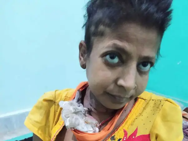 Support Mohini  Recover From Kidney and Liver Failure