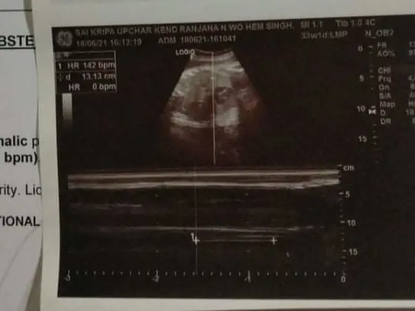 Please Help Ranju Pregnancy Operation