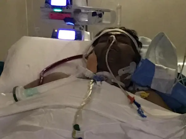 This 41 Years Old Needs Your Urgent Support In Recovering  Lung Infection Due To Covid