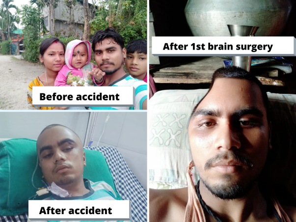 Urgent Brain Surgery Support For Factory Worker After Losing Job