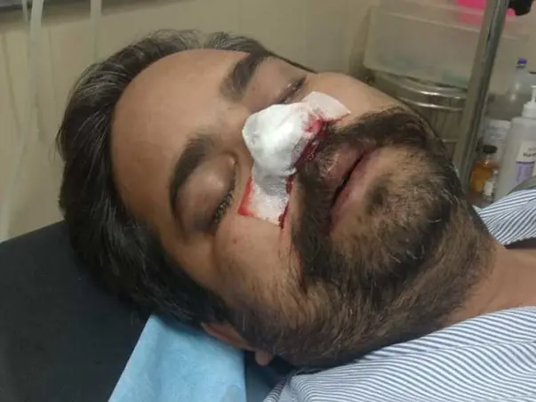 My Cousin Is Struggling With Mucormycosis, Help Him
