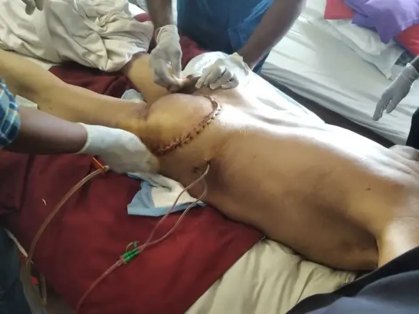 Support An Alone Old Handicapped Man To Recover From Surgery.