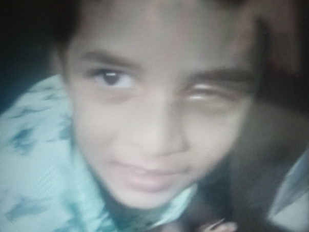Support My Son To Undergo Eye Surgery