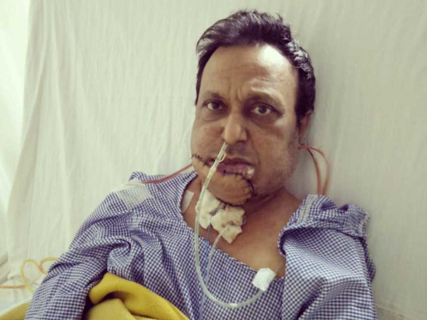 Help My Father in law Recover From Oral Cancer