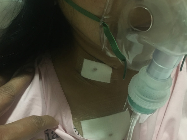 Help Afreen fight Signet Ring Cell Carcinoma, a very rare Cancer