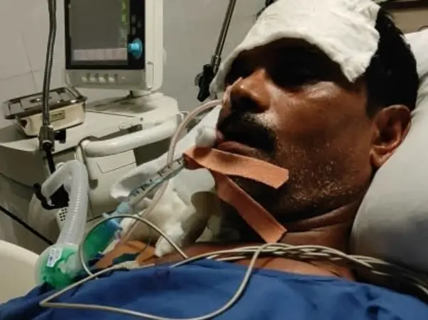 Help My Dad To Recover From Multi-organ Failure