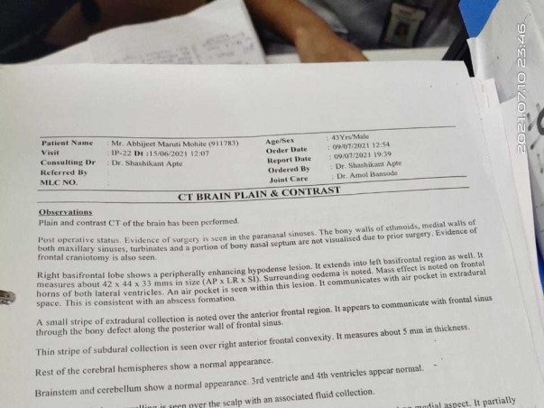 Help My Friend Abhijeet Mohite Recover From Mucormycosis (Black Fungus)