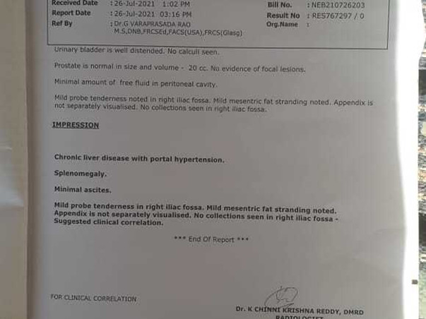 Support Khan To Undergo Liver Transplantation