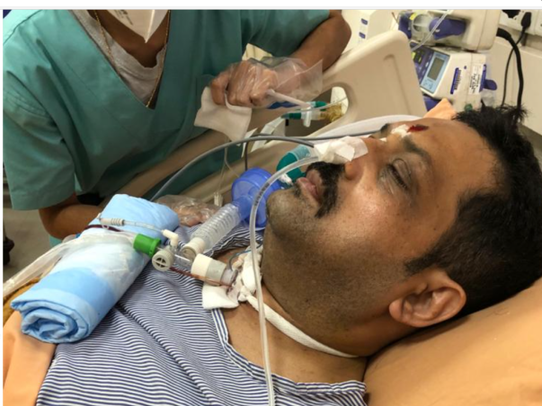 Support My Brother To Recover From Brain Stroke