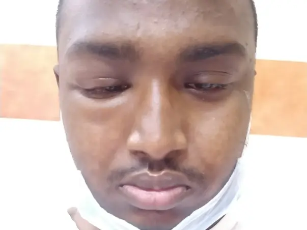 I Need Your Support To Continue My Kidney Treatment