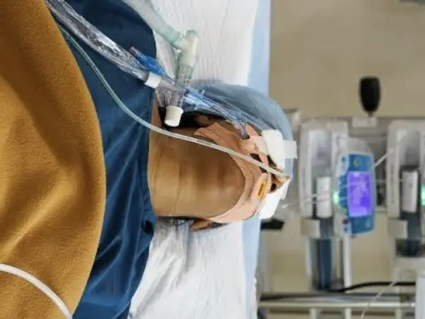 Help My Mother, Seema Panwar Recover From Cancer & Covid-19