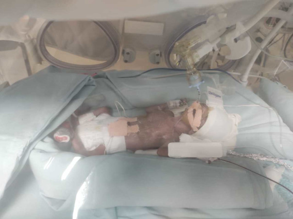 This Mother Gave Birth To A Premature Baby Due To COVID Complications