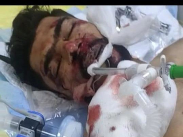 Help My Brother Fareez Recover From A Tragic Accident