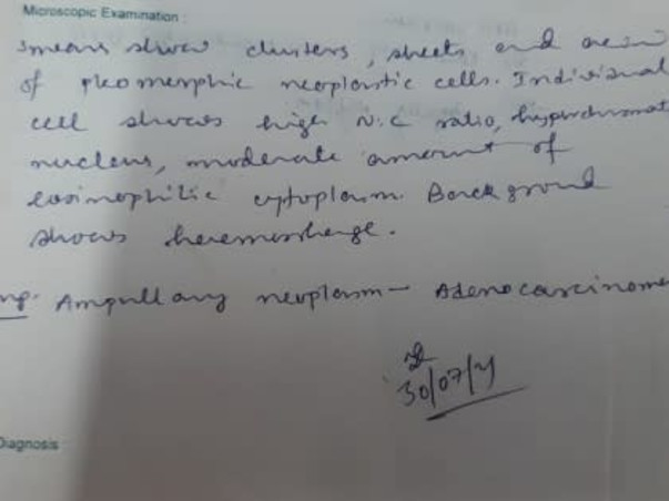Support Subhasish Roy Chowdhury To Recover From Ampullary Carcinoma