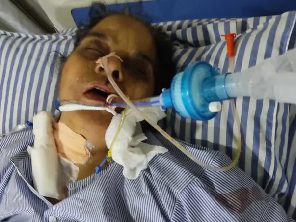 Help My Mother To Recover From Kidney Failure and Lungs failure
