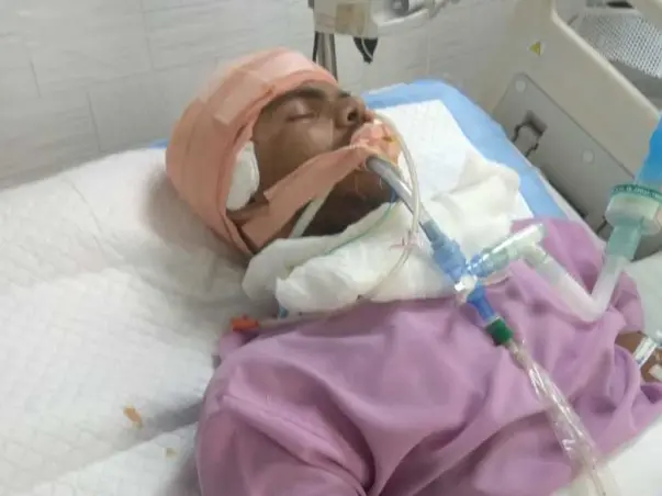 Help Gandu Fight Brain Operation