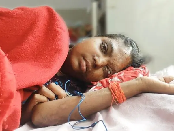 Help Acid Attack Survivor Bala Undergo Kidney Transplant