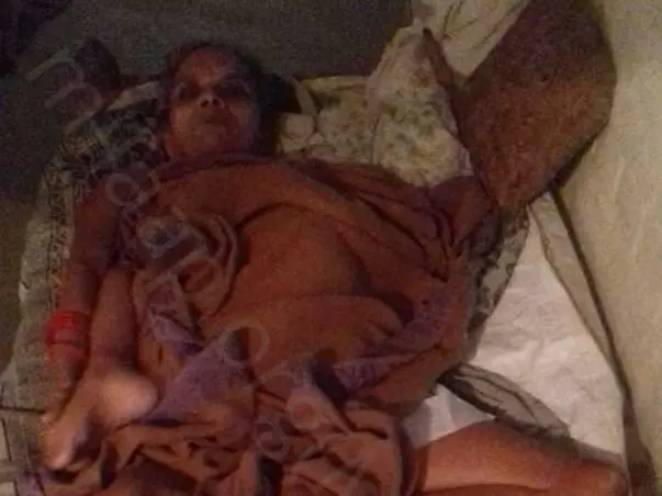 Support Rukhmani Pandey To Recover From Paralysis