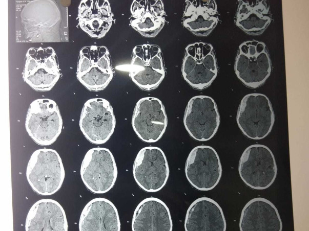 Support My Brother Mohd Ahsan Ali Khan Recover From Brain Hemorrhage