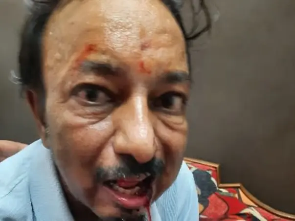Support Rajendra Bansiwala Recover From Oral Cancer