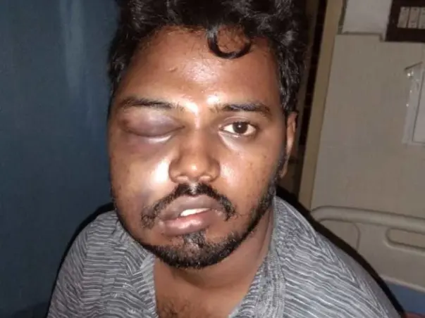 Please Support My Brother To Recover From Accidental Injuries