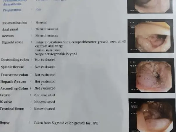 Support Arjun Recover From Colorectal Cancer
