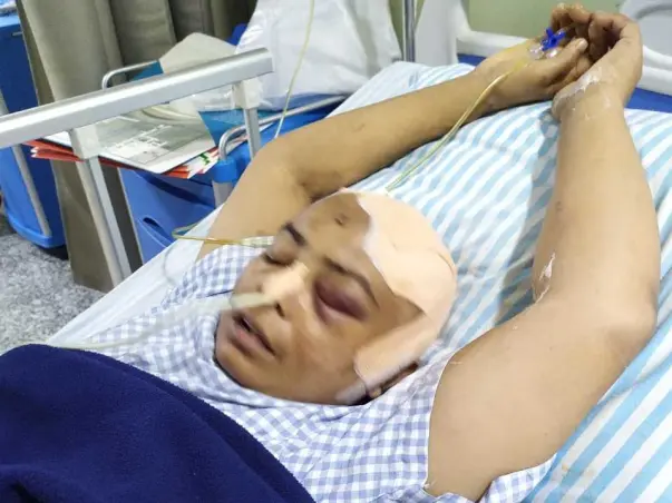 Help My Mother, Koutam Urmila 50Yrs/O Recover From Brain Tumor