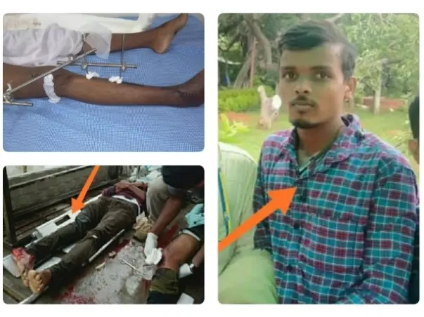 Support Ramesh To Recover From Accidental Injuries