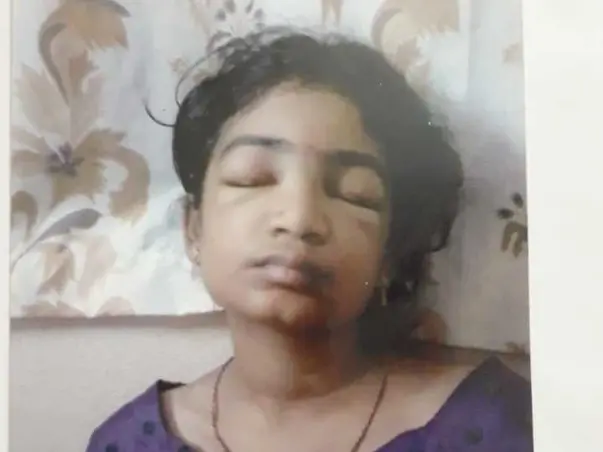 Help Gayatri For Her Kidney Failure Treatment