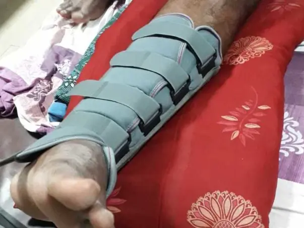 32 Years Old Pallaya Needs Your Help Recover Knee Fracture