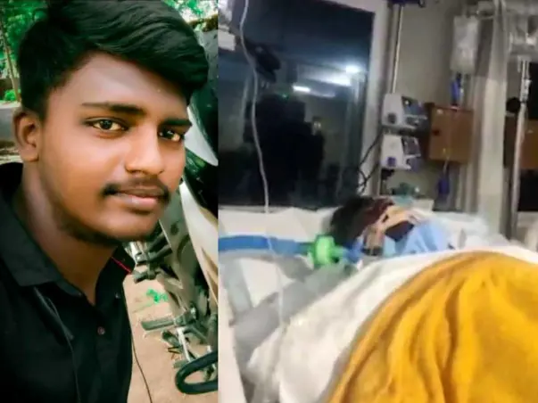 22-year-old Siva with Serious jaundice and emergency Liver Transplant