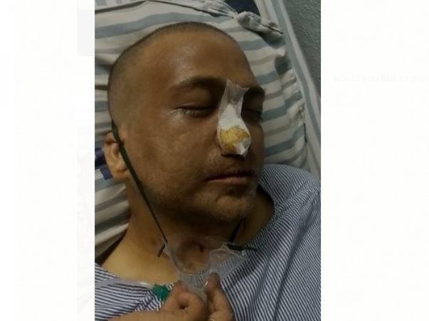 Support 47 Years Old Maria Rajan Recover From Black Fungus