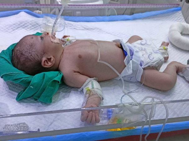 Please Support Baby Of Neeraj Suffering from Post-term Birth