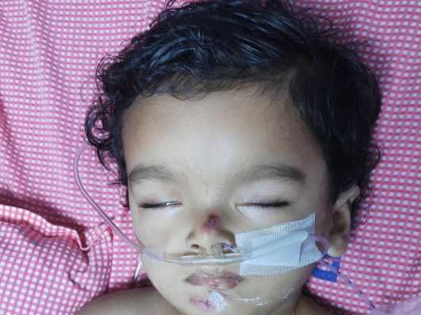 Help My Daughter Fight Spinal Muscular Atrophy (SMA Type-1).