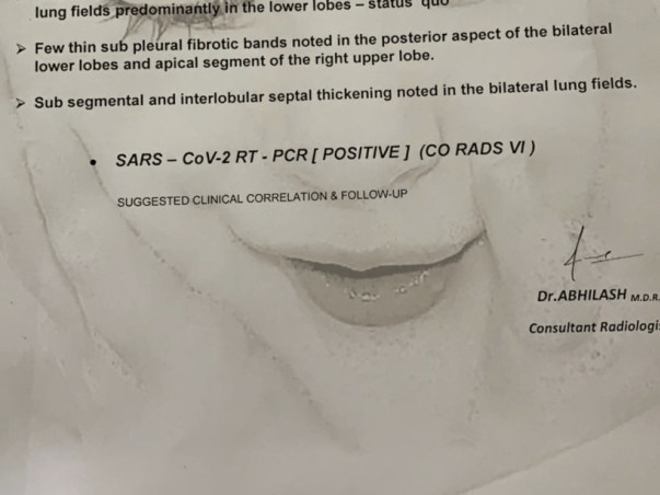 Help G.S Raju recover from Lungs Infection & Covid