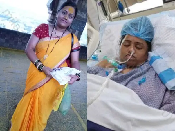 29 Years Old Karuna Mhatre Needs Your Help To Recover From  Paralysis Due To Brain Odema