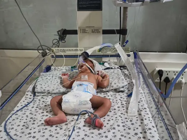 Baby of nirmala fight with lungs infection