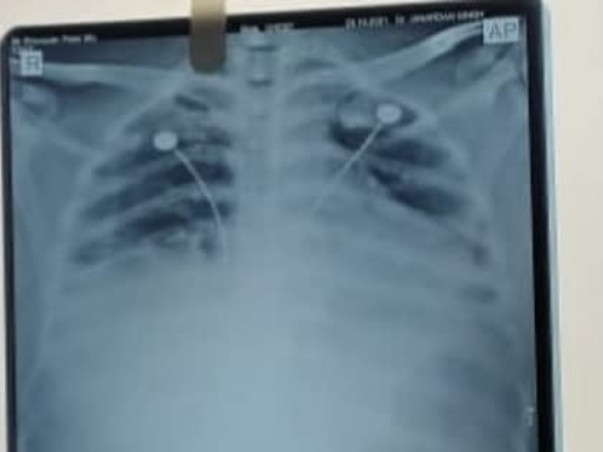 Support Shivpujan Patel Recover From Multiple Organ Failure