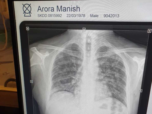 Help Manish Beat Cancer