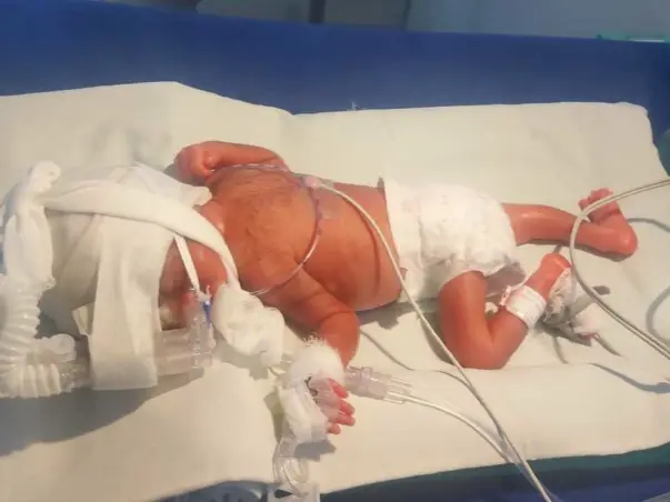 Help Amrita raise fund for her premature child