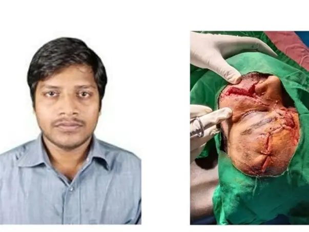 Help our friend chinnam madhu fight Head injury due to accident