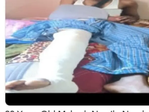 23 Years Old Mahesh Namile Needs Your Help & Support To Recover From Accidental Injuries